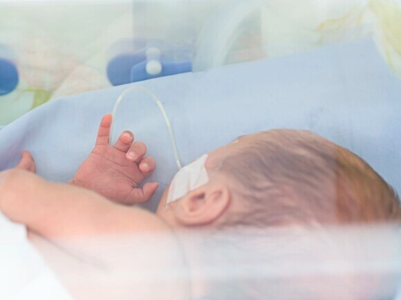 Preguntas y respuestas sobre bebés prematuros